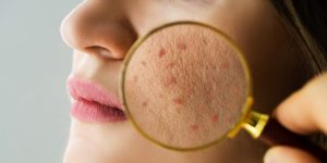 Dermatologie